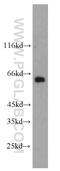 Plastin-2 antibody, 55208-1-AP, Proteintech Group, Western Blot image 