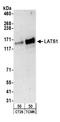 WARTS antibody, A300-477A, Bethyl Labs, Western Blot image 