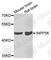 Inositol polyphosphate 5-phosphatase K antibody, A7807, ABclonal Technology, Western Blot image 