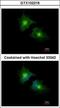 Secretory Carrier Membrane Protein 3 antibody, GTX102216, GeneTex, Immunocytochemistry image 