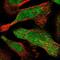 CutC Copper Transporter antibody, PA5-58469, Invitrogen Antibodies, Immunofluorescence image 
