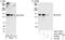 A-Kinase Anchoring Protein 1 antibody, A301-379A, Bethyl Labs, Immunoprecipitation image 