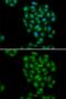 Phospholipid Scramblase 1 antibody, GTX33488, GeneTex, Immunofluorescence image 