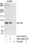 Mitogen-Activated Protein Kinase Kinase Kinase 20 antibody, A301-994A, Bethyl Labs, Immunoprecipitation image 