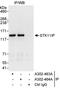Serine/Threonine Kinase 11 Interacting Protein antibody, A302-463A, Bethyl Labs, Immunoprecipitation image 