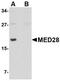 Mediator of RNA polymerase II transcription subunit 28 antibody, NBP1-76931, Novus Biologicals, Western Blot image 