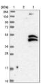 Chromosome 21 Open Reading Frame 91 antibody, PA5-53773, Invitrogen Antibodies, Western Blot image 