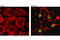 Poly(ADP-Ribose) Polymerase 1 antibody, 9148S, Cell Signaling Technology, Immunocytochemistry image 