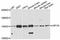 Huntingtin-interacting protein 1-related protein antibody, A12026, ABclonal Technology, Western Blot image 