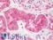 Oncostatin-M antibody, LS-C211362, Lifespan Biosciences, Immunohistochemistry paraffin image 