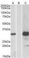 BTB/POZ domain-containing protein KCTD11 antibody, MBS422601, MyBioSource, Western Blot image 