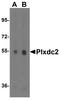 Plexin domain-containing protein 2 antibody, NBP1-76858, Novus Biologicals, Western Blot image 