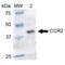 C-C chemokine receptor type 2 antibody, SPC-704D-A390, StressMarq, Western Blot image 