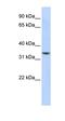 NHL Repeat Containing 3 antibody, orb325175, Biorbyt, Western Blot image 