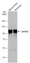 DLG3 antibody, GTX133279, GeneTex, Western Blot image 
