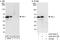 ETS Proto-Oncogene 1, Transcription Factor antibody, A303-500A, Bethyl Labs, Western Blot image 