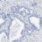 Glial Cells Missing Transcription Factor 1 antibody, HPA011343, Atlas Antibodies, Immunohistochemistry paraffin image 