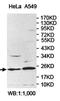 AP-3 complex subunit sigma-1 antibody, orb78298, Biorbyt, Western Blot image 