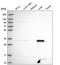 Fumarylacetoacetate Hydrolase Domain Containing 2A antibody, HPA044987, Atlas Antibodies, Western Blot image 