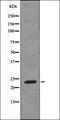 Heart And Neural Crest Derivatives Expressed 1 antibody, orb335731, Biorbyt, Western Blot image 