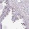 Deltex E3 Ubiquitin Ligase 4 antibody, HPA059294, Atlas Antibodies, Immunohistochemistry frozen image 