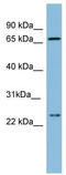 Solute Carrier Family 6 Member 8 antibody, TA346413, Origene, Western Blot image 