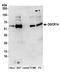 Protein DGCR14 antibody, A304-566A, Bethyl Labs, Western Blot image 