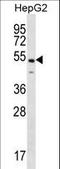 NF-kappa-B-activating protein antibody, LS-C164886, Lifespan Biosciences, Western Blot image 
