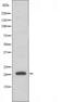 Deoxycytidine kinase antibody, orb228755, Biorbyt, Western Blot image 