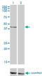 Proteasome 26S Subunit, ATPase 6 antibody, LS-C198020, Lifespan Biosciences, Western Blot image 