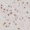 Zinc finger protein 830 antibody, NBP1-88165, Novus Biologicals, Immunohistochemistry paraffin image 