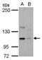 Kinesin Family Member C2 antibody, NBP2-17061, Novus Biologicals, Western Blot image 