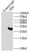 Mitochondrially Encoded NADH:Ubiquinone Oxidoreductase Core Subunit 1 antibody, FNab05597, FineTest, Immunoprecipitation image 