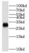 Protein Phosphatase, Mg2+/Mn2+ Dependent 1M antibody, FNab06690, FineTest, Western Blot image 