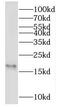 NME/NM23 Nucleoside Diphosphate Kinase 3 antibody, FNab05764, FineTest, Western Blot image 