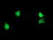 ALG2 Alpha-1,3/1,6-Mannosyltransferase antibody, M06556-1, Boster Biological Technology, Immunofluorescence image 
