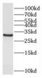 Chromosome 11 Open Reading Frame 49 antibody, FNab01003, FineTest, Western Blot image 