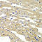 BCL2 Antagonist/Killer 1 antibody, LS-C746742, Lifespan Biosciences, Immunohistochemistry paraffin image 
