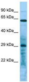 Leucine Rich Repeat Containing 10 antibody, TA333331, Origene, Western Blot image 
