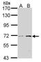 Peroxisomal carnitine O-octanoyltransferase antibody, PA5-21650, Invitrogen Antibodies, Western Blot image 