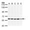 DnaJ Heat Shock Protein Family (Hsp40) Member C3 antibody, GTX111383, GeneTex, Western Blot image 