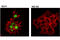 DNA Methyltransferase 3 Beta antibody, 67259T, Cell Signaling Technology, Immunofluorescence image 