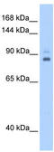 TPX2 Microtubule Nucleation Factor antibody, TA339307, Origene, Western Blot image 