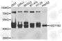 Corticosteroid 11-beta-dehydrogenase isozyme 2 antibody, A8077, ABclonal Technology, Western Blot image 