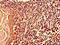 Myosin-X antibody, A62998-100, Epigentek, Immunohistochemistry paraffin image 