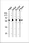 Ubiquitin Specific Peptidase 14 antibody, TA324906, Origene, Western Blot image 