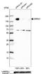 Serine And Arginine Repetitive Matrix 1 antibody, NBP2-57064, Novus Biologicals, Western Blot image 