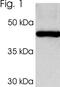 Proteasome 19S Rpt3/S6b subunit antibody, PA1-968, Invitrogen Antibodies, Western Blot image 