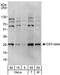 Casein kinase II subunit beta antibody, NBP1-06514, Novus Biologicals, Western Blot image 