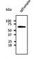 Integrin Subunit Alpha 2b antibody, orb181793, Biorbyt, Western Blot image 